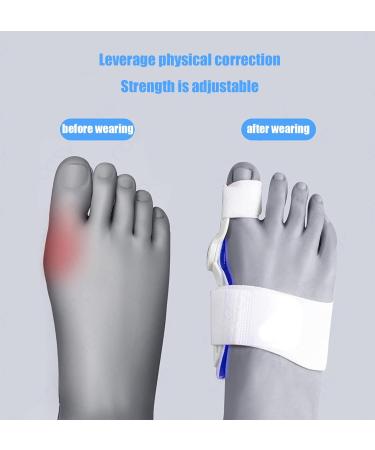 ALINZO Bunion Corrector - Orthopedic Big Toe Separator for Pain Relief - Non-Surgical Hallux Valgus Correction - Day & Night Support (Blue) - Buy Online on GoSupps.com