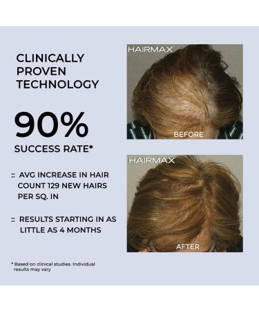 Hairmax LaserBand 82 ComfortFlex - FDA Cleared Hair Growth Laser for Men & Women - Full/Partial Coverage - 100% Medical Grade Lasers - Buy Online on GoSupps.com