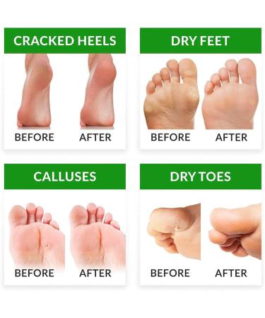 FC Fancy Foot Peeling Mask - 3 Pairs | Natural Exfoliating Socks for Baby Soft Feet | Lavender Rose & Chamomile | Cornea Removal for Men & Women - Buy Online on GoSupps.com