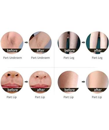  pilation Rapide Opt Shr/Shr E Light/Shr Ipl Machine de rajeunissement de la Peau Bleu - Buy Online on GoSupps.com