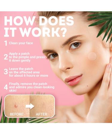 Acne Pimple Patch - 120 Pack Clear Zit Patches with Tea Tree & Calendula Oil | 3 Sizes for Face & Body - Buy Online on GoSupps.com