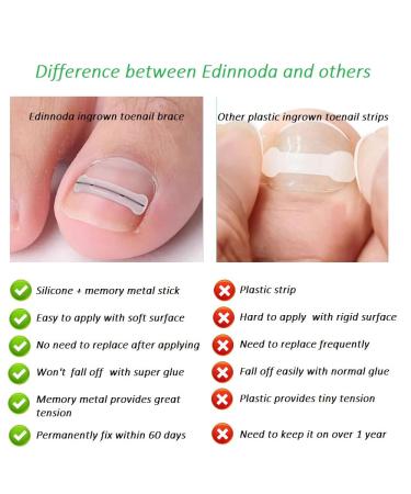 Ingrown Toenail Corrector - Upgrade Your Toe Nail Health with Our Toe Nail Brace & Lifter - Patent Pending Solution for Adult Largest Toenails (20mm Pack of 8 - Buy Online on GoSupps.com