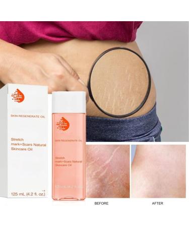  Optimal Oil Collagen Boost Firming & Lifting Skincare Oil Optimal Oil Lifting Skincare Optimal Oil Lifting Skincare Oil Optimal Oil Skin Care Oil for All Skin Types 125ml/4.2fl.oz - Buy Online on GoSupps.com