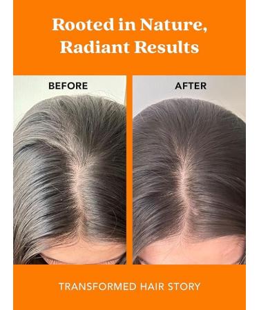 Soothing Grapeseed & Methi Shampoo for Dandruff Relief | 300ml - International Shipping - Buy Online on GoSupps.com