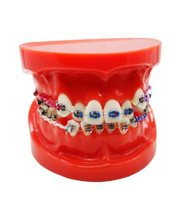 Dental Typodont With Metal Brackets Orthodontic Teeth Model With Ligature Ties Red