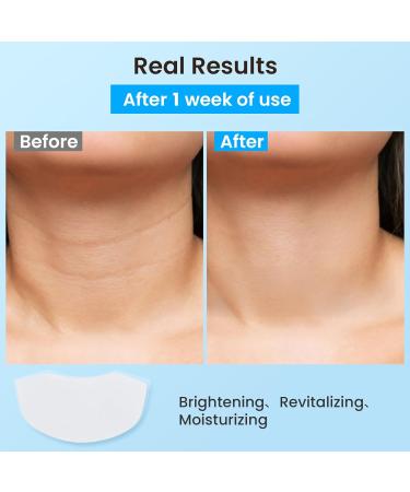 AUSLKA Neck Wrinkle Patches Moisturizing Hydrolyzed Collagen Mask Become Transparent Neck Masks Deep Hydration & Elasticity Boost Neck Lifting Firming Pads for Tightening Skin 5 PCS - Buy Online on GoSupps.com