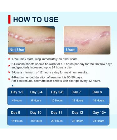 Scar Away Silicone Scar Sheets - Professional Scar Tape for Surgery, Injury, Burns, Acne - Soften and Flatten Scars - Medical Grade (1.6x115 Inch) - Buy Online on GoSupps.com