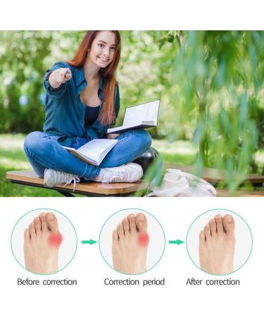 Valgus Correction Rail & Hallux Valgus Toe Separator Set - Bunion Corrector Socks & Big Toe Strap - Premium 2 Pair Beige - Buy Online on GoSupps.com