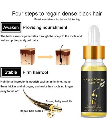 Anti Hair Loss Products Organic Hair Regrowth Kit Ginger Oil Hair Regrowth Serum with Activation Roller Promotes Thickening Repairs Hair Follicles - Buy Online on GoSupps.com