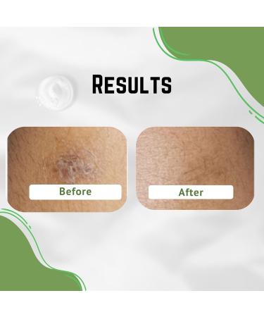 Aloe Vera Cream for Dark Spot Removal | Blemish Treatment & Scar Reducer | Face Cream for Men Women & Kids - Buy Online on GoSupps.com