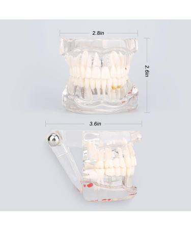 Boxwizard Tooth Model for Dentistry Students | Typodont Dental Diseases Teaching Aid - Adult Demonstration Tooth Model - Buy Online on GoSupps.com