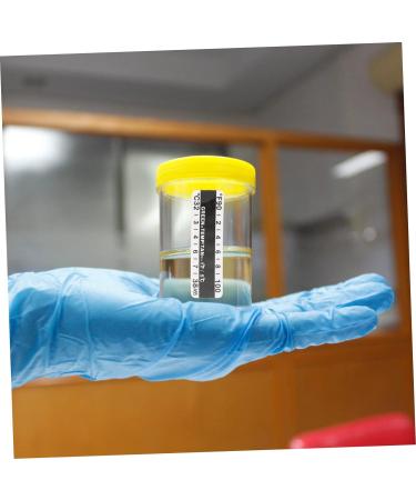 Urine Temp Strips 25pcs | Fish Tank Test Strips | Urinalysis Sticker - Buy Online on GoSupps.com