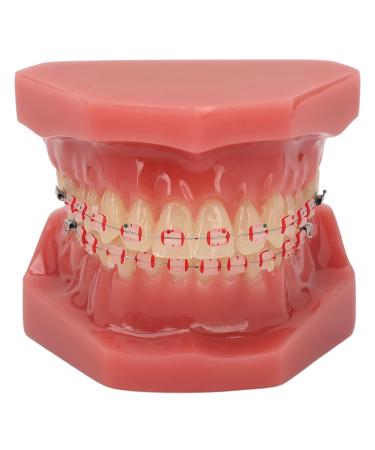 Orthodontic Demonstration Model for Dental Research | Metal Wires & Ceramic Brackets | Teaching Aids for Adults - Buy Internationally - Buy Online on GoSupps.com