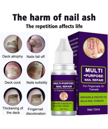 Nail Repair Toenail Care Solution Multi-purpose Renewl Restores Discolored and Damaged Nails 10 ML cracked nail repair gel - Buy Online on GoSupps.com