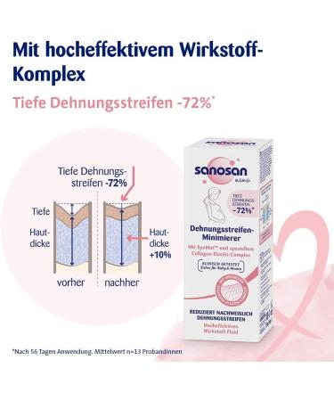 Sanosan Expansion Strips Minimier - Clinically Tested Stretch Mark Reduction Cream (2x75ml) - Paraffin Oil Dye & Silicone Free - Post-Pregnancy Care - Buy Online on GoSupps.com