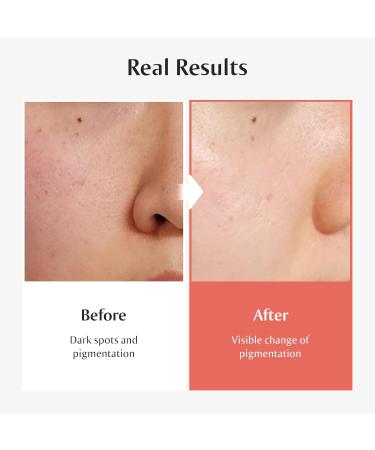  Redence Spot & Pore Fix Duo : 605,395ppm Vitamin C Tone & Spot Serum + Deep Pore Cleansing Oil - Buy Online on GoSupps.com