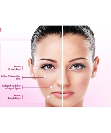 Buy Intensive Anti-Wrinkle & Anti-Aging Collagen Treatment | Vitamin C Formula for Youthful Skin International Shipping Available - Buy Online on GoSupps.com