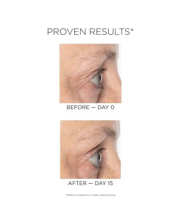 IDC Dermo Boost Collagen Pro Serum - Anti-Aging Facial & Neck Treatment | Lightweight Hyaluronic Acid Formula for All Skin Types - 1 fl oz - Buy Online on GoSupps.com