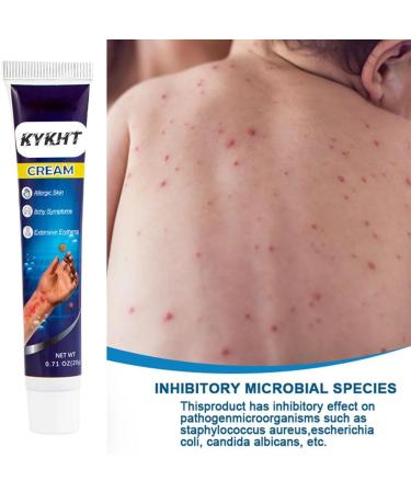 KYKHT Urticaria Antipruritic Ointment Urticaria Curing Plaster Ointment Balm Urticaria Ointment Urticaria Antipruritic Plaster Ointment Balm White Hives Ointment Cream Bottled (3PCS) - Buy Online on GoSupps.com
