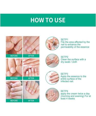 ZZBD 30ML-Kerassentials Toenail Fungus Treatment Oil Kerassentials Nail Treatment Kerassentials for Toenail Fungus for Healthy Natural Repair Nails-3pcs - Buy Online on GoSupps.com