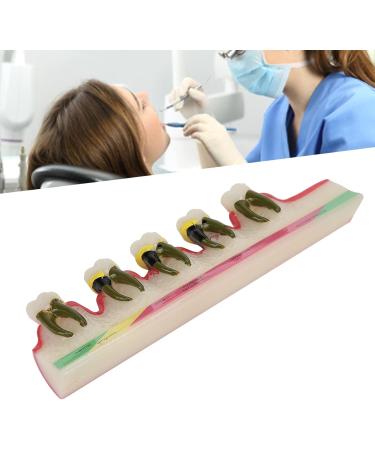 Shop Verdant Touch Tooth Model - Dental Periodontal Disease Study Tool for Schools | International Shipping Available - Buy Online on GoSupps.com