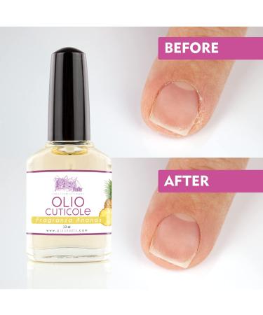 Ananas Cuticle Oil 12ml - Moisturizing & Regenerating Nail Treatment - Soothes Dry Irritated Skin - Buy Online on GoSupps.com
