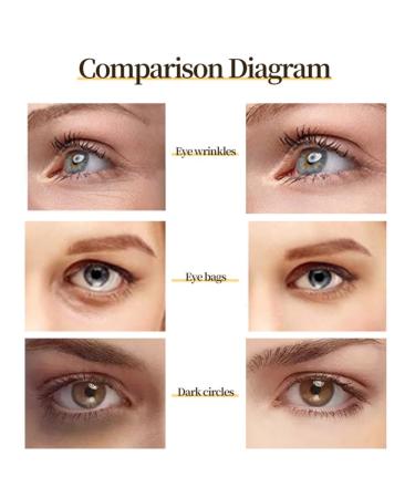 Buy 24K Gold Eye Masks for Puffy Eyes & Dark Circles | Anti-Wrinkle Treatment | Revitalize & Refresh Your Skin - International Shipping - Buy Online on GoSupps.com