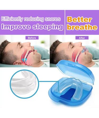 2024 Snoring Solution Device | Effective Stop Snoring Aid for Comfortable Sleep | Clear-Hyt-1220 - Buy Online on GoSupps.com