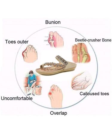 Women s Thumb Orthotic Sandals - Summer Bohemia Crystal Slip-On Bunion Sandals for Big Toe Correction & Arch Support | Casual Floral Beach Flats - Size 8 Blue - Buy Online on GoSupps.com