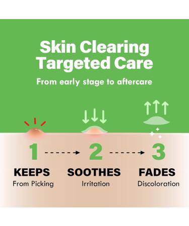 NOSCA9 Hydrocolloid Pimple Patches - Ultra-Slim Salicylic Acid & Niacinamide Spot Treatment | 72 + 30 EA Korean Acne Patches for Maximum Coverage - Buy Online on GoSupps.com
