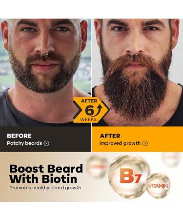 Luxury Waking Forest Beard Growth Kit | Essential Beard Care for Men - Oil Wash Balm & Comb for Patchy Beards | Perfect Gift for Dad & Husband - Buy Online on GoSupps.com