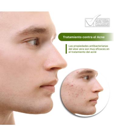 Premium Aloe Vera Gel & Cream 500ml - Moisturizing for Face & Body | Sunburn Relief Acne Treatment & Soothing Razor Burn for Men & Women - Buy Online on GoSupps.com