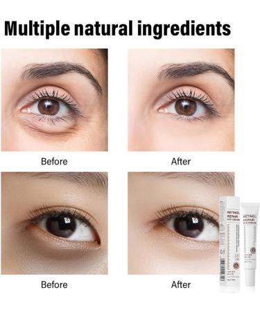 Retinol Eye Cream Retinol Serum Eye Cream for Dark Circles and Puffy Eyes Eye Cream with Retinol & AHA 30% & BHA 2% & Hyaluronic Acid for Fine Lines & Wrinkles Saggy Skin Puffy Eyes - Buy Online on GoSupps.com