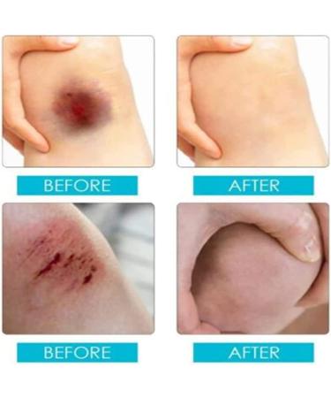 2Pcs Liquid Bandage Spray for Cuts and Scrapes - No Sting, Promotes Healing of Cracked Skin - Buy Online on GoSupps.com