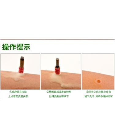 180 Pcs Moxibustion Sticks - Self-Adhesive Mini Moxa Tubes for Acupuncture Therapy | Chinese Moxibustion Stickers - Buy Online on GoSupps.com