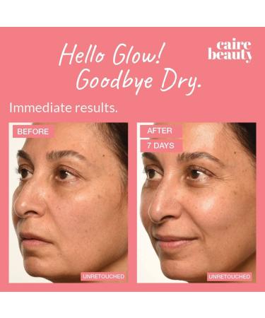 Caire Own Your Age Hyaluronic Acid Peptide Serum | Anti-Aging Face Eyes & Neck Treatment for Women 40+ | 30ml Wrinkle Fighting & Collagen Boosting - Buy Online on GoSupps.com