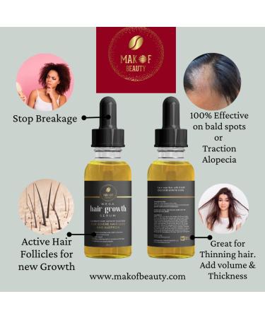 Makof Hair Growth Treatment Serum and Capsules for Severe Hair Loss and Alopecia | Keratin, Biotin, Collagen for Thicker, Fuller Hair - Buy Online on GoSupps.com
