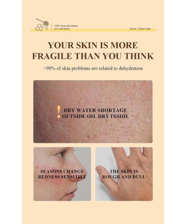 Sheghy Beef Tallow and Honey Balm for Skin Natural Grass-Fed Beef Tallow & Raw Wild Honey Moisturizer for Face & Body Organic Tallow Skin Care Cream with Vitamin E for Skin Hydration (1pc) - Buy Online on GoSupps.com