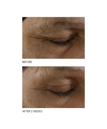 Dr Dennis Gross B Adaptive SuperFoods Stress SOS Eye Cream - 0.5 fl oz | Targets Tired Eyes, Worry Lines, Crepiness & Puffiness - Buy Online on GoSupps.com