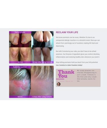 Comizla Psoriasis Cream for Itchy Irritated Skin 100% Steroid Free Prevents Scalp and Plaque Psoriasis Plant Based Stem Cell Enriched. - Buy Online on GoSupps.com