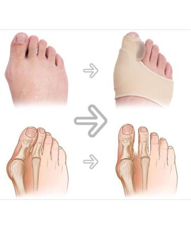 Willq Hallux Valgus Correction - Large Toe Separator & Orthopedic Bunion Relief for Overlapping Toes - Buy Online on GoSupps.com