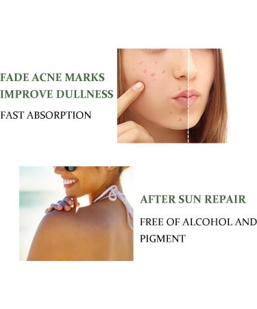 Pure Aloe Vera Gel After Sun Aloe Vera Moisturiser - Deeply Hydrate Organic Aloe Vera Gel Absorbs Rapidly Aloe Vera Face Cream Soothing After Sun Care Gel Body Moisturisers Aloe Vera Gel for Face - Buy Online on GoSupps.com