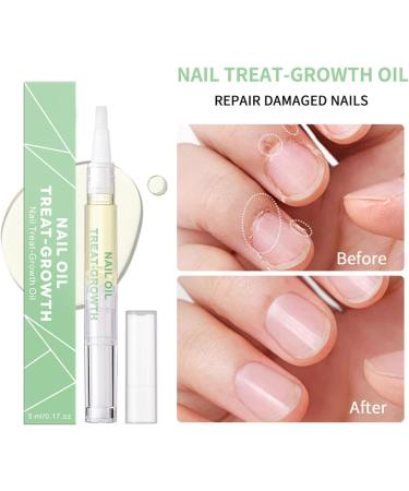 Ruarby Nail Oil Growth Cuticle Oil Moisturize Strengthen Nails Care for Damaged Nails and Cuticle Repair Cuticle Oil Nail Treat - Buy Online on GoSupps.com