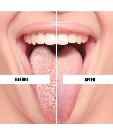 Stainless Steel Tongue Scraper Set - 3 Piece Tongue Cleaners for Optimal Oral Hygiene | Safe & Comfortable - Buy Online on GoSupps.com