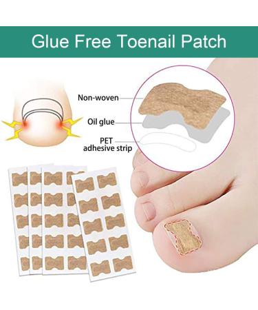 60 Pcs Toenail Correction Patch - Ingrown Toenail Corrector Tools for Perfect Pedicure - Buy Online on GoSupps.com