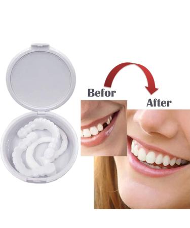 2 Pairs of Instant Veneers Dentures - Temporary False Teeth for Whitest Smile | Cosmetic Above & Below Tooth Covers - Buy Online on GoSupps.com