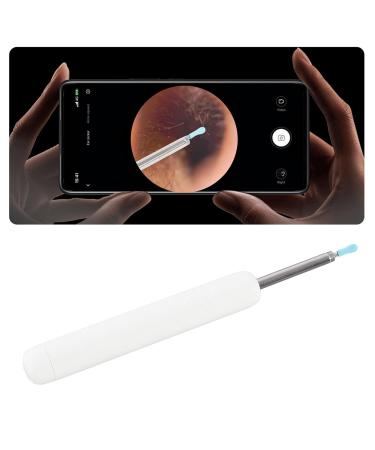 1080P Ear Cleaner Tool with Micro Camera & LED Light - Waterproof Ear Wax Removal for Family Use - Lasts 30 Days - Buy Online on GoSupps.com