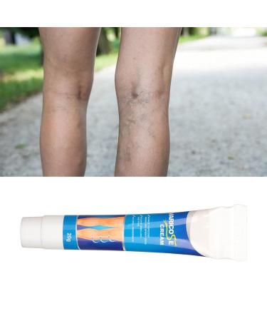 Varicose Veins Cream | Eliminate Spider Veins & Soothing Treatment - International Shipping - Buy Online on GoSupps.com