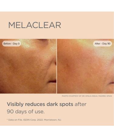 ISDIN Melaclear Dark Spot Correcting Serum - Vitamin C & Phytic Acid for Sensitive Skin - Buy Online on GoSupps.com