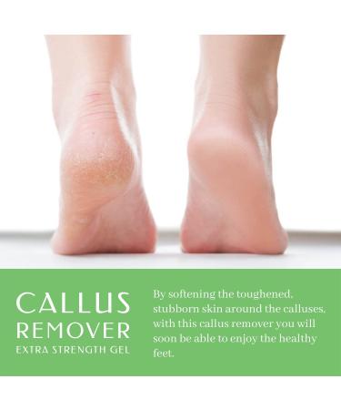 Extra-Strength Bella Feet Callus Remover Kit with Scrubber, Gloves & Repair Cream - Professional Foot Care for Dry Cracked Heels - 8.45oz/50ml - Buy Online on GoSupps.com